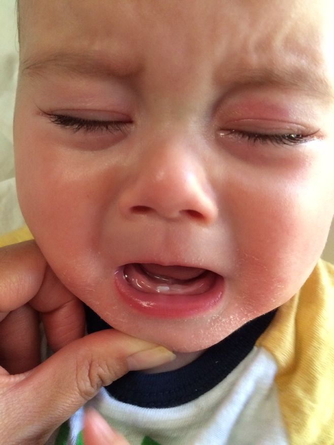 Baby with two teeth crying